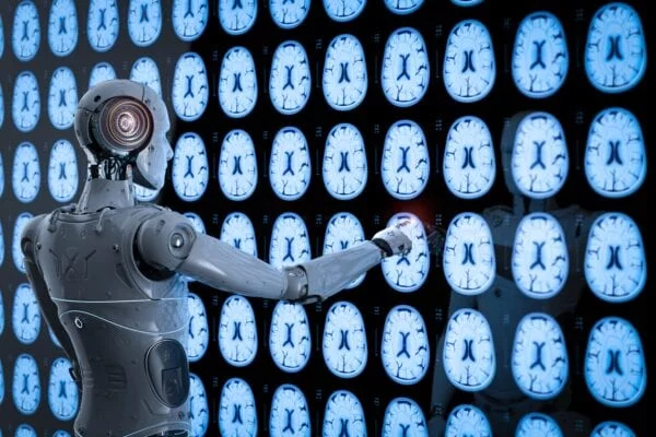 AI robot evaluating brain scans